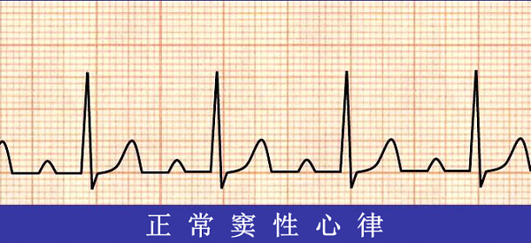 救命神器AED有多重要——你認識它嗎？(圖6)